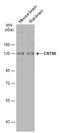 Contactin-5 antibody, GTX121400, GeneTex, Western Blot image 