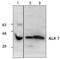 Activin A Receptor Type 1C antibody, TA319010, Origene, Western Blot image 