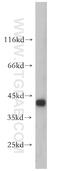 Hydroxymethylbilane Synthase antibody, 14797-1-AP, Proteintech Group, Western Blot image 