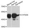 Cytochrome P450 Family 2 Subfamily D Member 6 antibody, abx126880, Abbexa, Western Blot image 