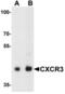 C-X-C Motif Chemokine Receptor 3 antibody, LS-B10183, Lifespan Biosciences, Western Blot image 