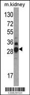 Dimethylarginine Dimethylaminohydrolase 1 antibody, 61-587, ProSci, Western Blot image 