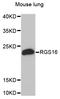 Regulator Of G Protein Signaling 16 antibody, STJ25346, St John