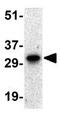 Baculoviral IAP Repeat Containing 7 antibody, GTX31663, GeneTex, Western Blot image 