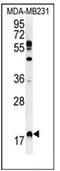 Ras Homolog, MTORC1 Binding antibody, AP53656PU-N, Origene, Western Blot image 