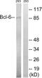 BCL6 Transcription Repressor antibody, abx012967, Abbexa, Western Blot image 
