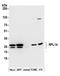 Ribosomal Protein L14 antibody, A305-052A, Bethyl Labs, Western Blot image 