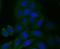 Sterol 26-hydroxylase, mitochondrial antibody, NBP2-76827, Novus Biologicals, Immunocytochemistry image 