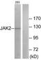 Janus Kinase 2 antibody, TA314113, Origene, Western Blot image 