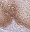 PGAM Family Member 5, Mitochondrial Serine/Threonine Protein Phosphatase antibody, NBP1-92257, Novus Biologicals, Immunohistochemistry frozen image 