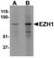 Histone-lysine N-methyltransferase EZH1 antibody, TA319647, Origene, Western Blot image 