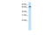 Zinc finger protein 64 antibody, ARP39337_T100, Aviva Systems Biology, Western Blot image 