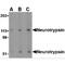 Serine Protease 12 antibody, MBS150097, MyBioSource, Western Blot image 