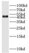 POU Class 3 Homeobox 4 antibody, FNab06652, FineTest, Western Blot image 