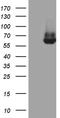 Estrogen Receptor 2 antibody, TA801087S, Origene, Western Blot image 