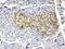 Insulin Like Growth Factor Binding Protein 1 antibody, A00922-1, Boster Biological Technology, Immunohistochemistry paraffin image 