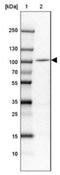 Spire Type Actin Nucleation Factor 1 antibody, NBP1-92439, Novus Biologicals, Western Blot image 