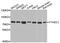 YTH Domain Containing 1 antibody, abx005525, Abbexa, Western Blot image 