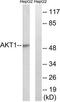 Akt antibody, TA313254, Origene, Western Blot image 