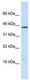 SPINK1 antibody, TA334673, Origene, Western Blot image 
