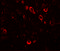 Cardiomyopathy Associated 5 antibody, 6403, ProSci, Immunofluorescence image 