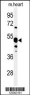 5'-Nucleotidase, Cytosolic IA antibody, 64-184, ProSci, Western Blot image 