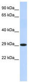 Hydroxysteroid 17-Beta Dehydrogenase 14 antibody, TA345048, Origene, Western Blot image 