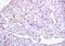 EGFR L858R antibody, orb47908, Biorbyt, Immunohistochemistry paraffin image 