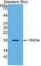 Leptin antibody, LS-C314373, Lifespan Biosciences, Western Blot image 