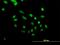 PHD Finger Protein 10 antibody, H00055274-B01P, Novus Biologicals, Immunofluorescence image 