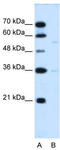 Major Facilitator Superfamily Domain Containing 12 antibody, TA335949, Origene, Western Blot image 