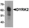 Dual specificity tyrosine-phosphorylation-regulated kinase 2 antibody, TA319749, Origene, Western Blot image 