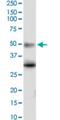 5-Hydroxytryptamine Receptor 5A antibody, H00003361-M02, Novus Biologicals, Western Blot image 