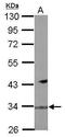 F-Box Protein 16 antibody, GTX119274, GeneTex, Western Blot image 