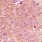 Neurobeachin Like 1 antibody, orb339041, Biorbyt, Immunohistochemistry paraffin image 
