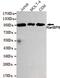 RanBP9 antibody, MA5-24763, Invitrogen Antibodies, Western Blot image 