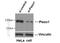 Protein PIEZO1 antibody, 15939-1-AP, Proteintech Group, Western Blot image 