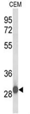 Katanin Regulatory Subunit B1 Like 1 antibody, AP50473PU-N, Origene, Western Blot image 