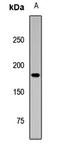 SET Binding Protein 1 antibody, LS-C668114, Lifespan Biosciences, Western Blot image 