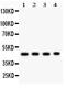 Methyl-CpG-binding domain protein 2 antibody, RP1049, Boster Biological Technology, Western Blot image 