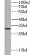 Killer Cell Lectin Like Receptor K1 antibody, FNab10477, FineTest, Western Blot image 