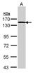 Forkhead box protein E1 antibody, NBP1-32842, Novus Biologicals, Western Blot image 
