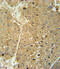 Alcohol Dehydrogenase 1C (Class I), Gamma Polypeptide antibody, 61-966, ProSci, Immunohistochemistry frozen image 