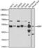 X-Linked Inhibitor Of Apoptosis antibody, A6869, ABclonal Technology, Western Blot image 