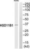 Hydroxysteroid 11-Beta Dehydrogenase 1 antibody, TA312234, Origene, Western Blot image 
