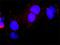E2F-1 antibody, H00001869-M01, Novus Biologicals, Proximity Ligation Assay image 