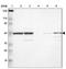 RNA Binding Motif Protein 22 antibody, NBP1-85379, Novus Biologicals, Western Blot image 