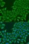 ATP Binding Cassette Subfamily F Member 2 antibody, LS-C747652, Lifespan Biosciences, Immunofluorescence image 