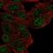 Malignant Fibrous Histiocytoma Amplified Sequence 1 antibody, HPA054471, Atlas Antibodies, Immunofluorescence image 