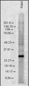 RAB4A, Member RAS Oncogene Family antibody, orb96512, Biorbyt, Western Blot image 